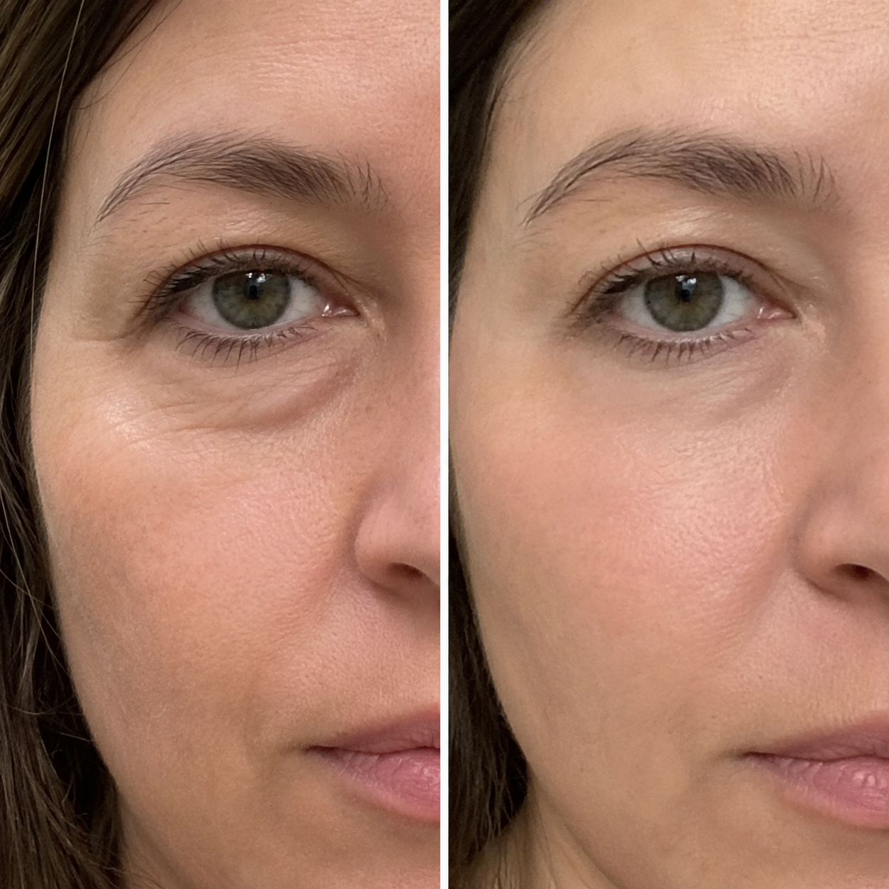 PRACTS Collagen Renewal Set - Eye Care Edition-FR